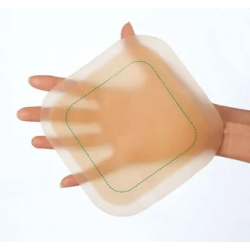 DUODERM E PANS 15*15CM 10